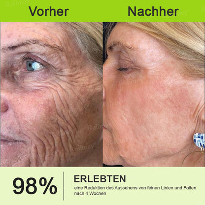 🍀👑✨Jetzt jugendliche Haut zurückgewinnen 💫Rolimey® Botox & Vita-A Retinol Shot Falten-Lift Straffungscreme
