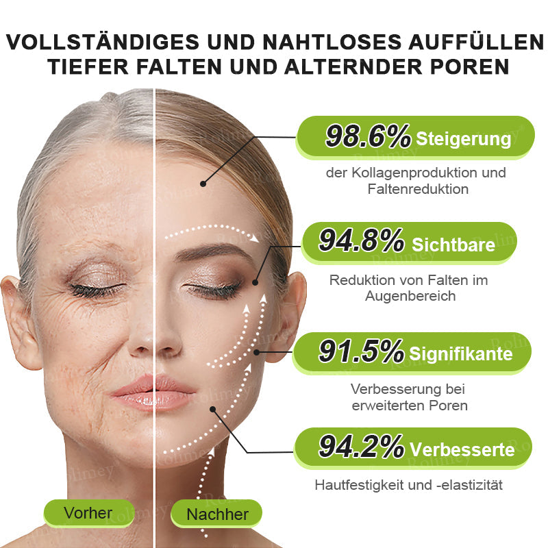 🍀👑✨Jetzt jugendliche Haut zurückgewinnen 💫Rolimey® Botox & Vita-A Retinol Shot Falten-Lift Straffungscreme