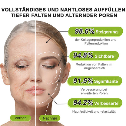 🍀👑✨Jetzt jugendliche Haut zurückgewinnen 💫Rolimey® Botox & Vita-A Retinol Shot Falten-Lift Straffungscreme