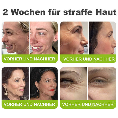 🍀👑✨Jetzt jugendliche Haut zurückgewinnen 💫Rolimey® Botox & Vita-A Retinol Shot Falten-Lift Straffungscreme