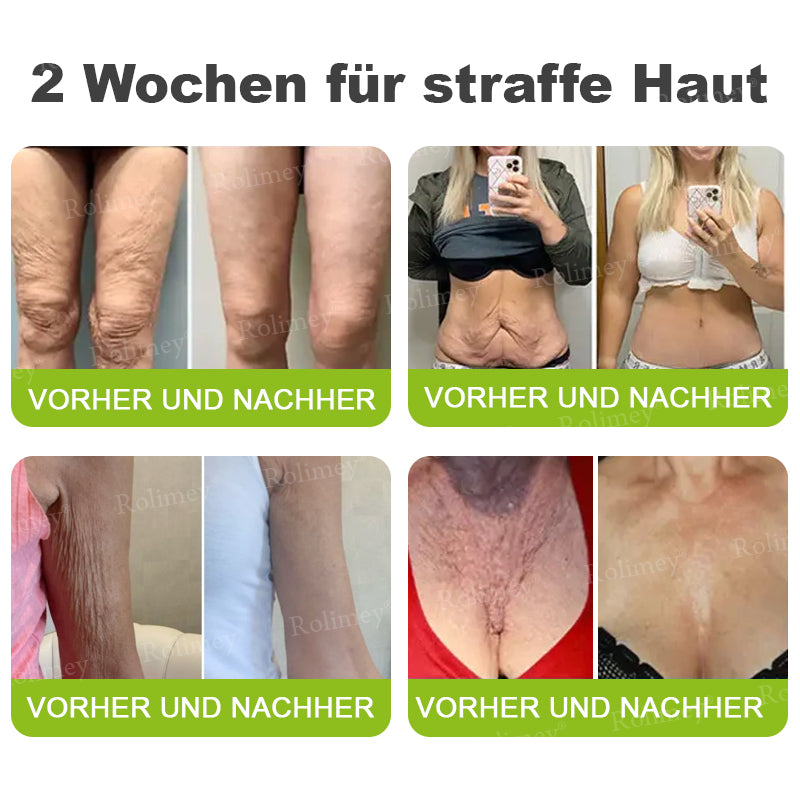 🍀👑✨Jetzt jugendliche Haut zurückgewinnen 💫Rolimey® Botox & Vita-A Retinol Shot Falten-Lift Straffungscreme