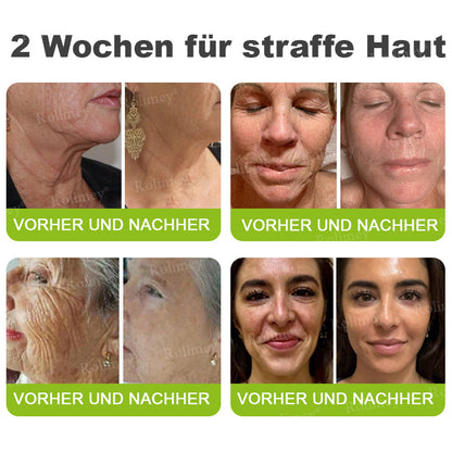 🍀👑✨Jetzt jugendliche Haut zurückgewinnen 💫Rolimey® Botox & Vita-A Retinol Shot Falten-Lift Straffungscreme